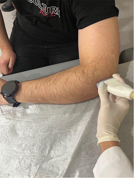 Ultrasonographic measurement of common